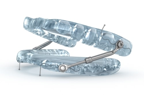 Sleep Apnea Treatment in Syraucse, NY