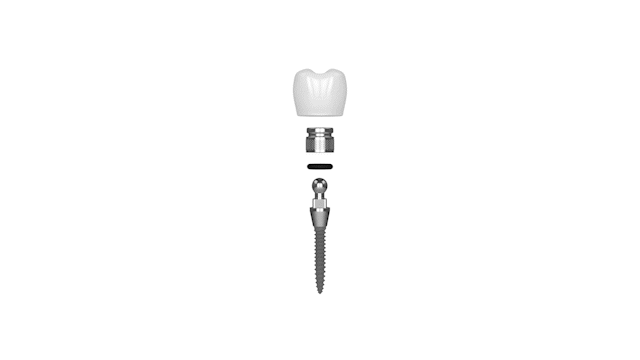 Extracción de dientes en Syracuse, NY | Mantener su sonrisa sana
