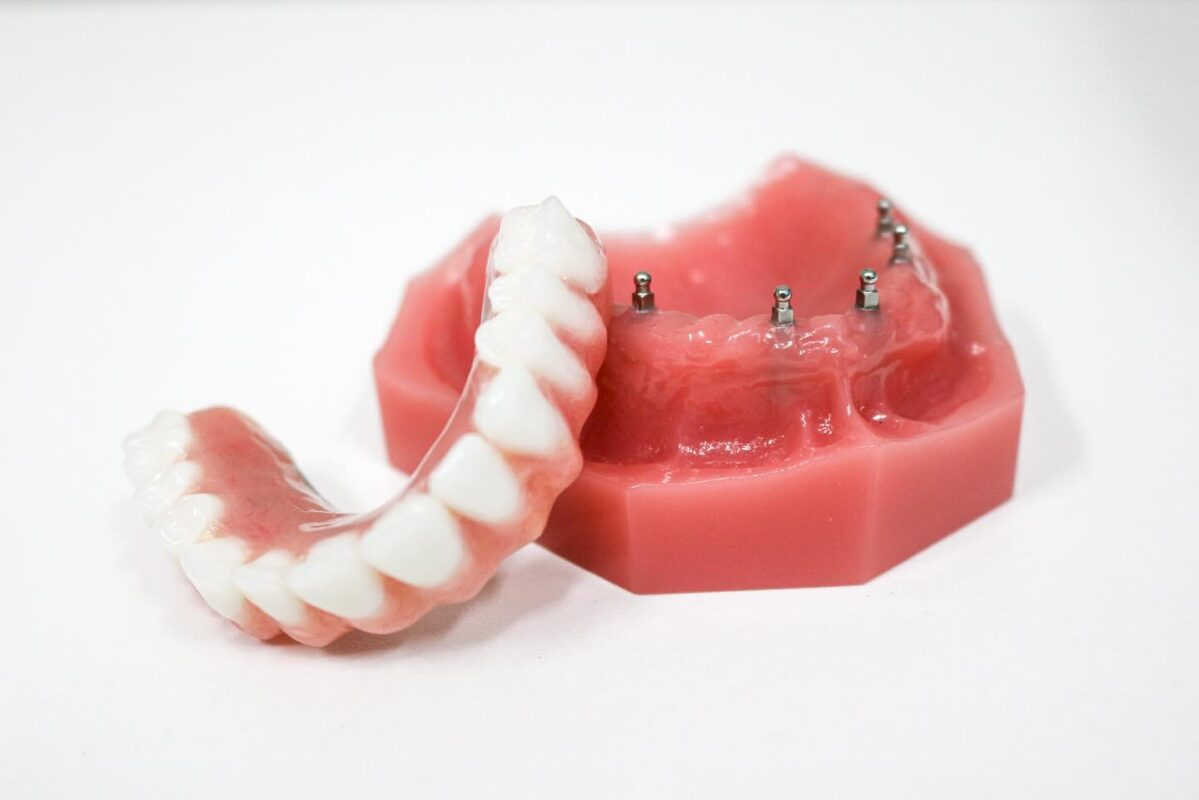 Denture Reline in Syracuse, NY | Free Implant Denture Consults