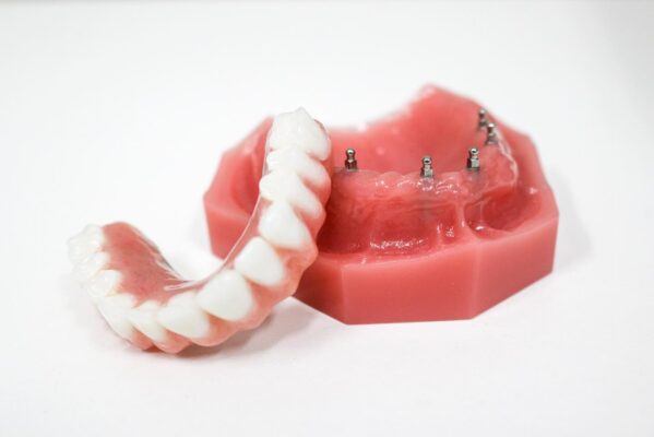 Denture Reline in Syracuse, NY | Free Implant Denture Consults
